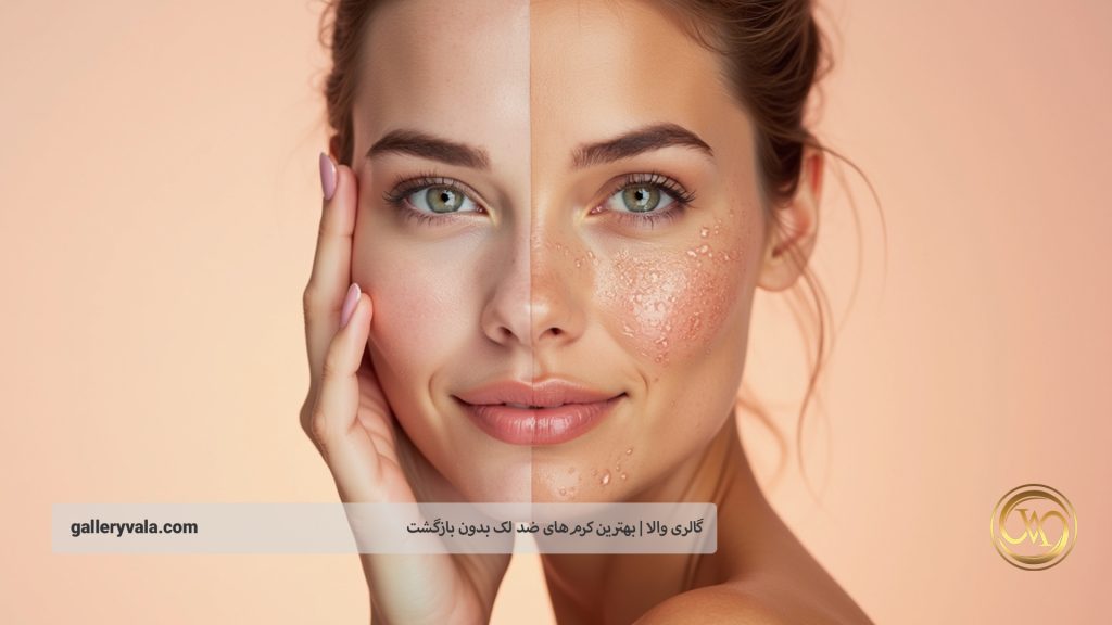 ویژگیهای کلیدی که بهترین کرمهای ضد لک را متمایز میکند