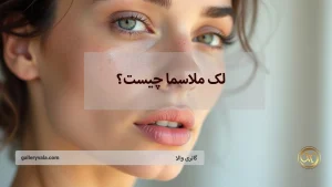 لک ملاسما چیست؟ بررسی علل پیدایش و موثرترین روش‌های درمان آن