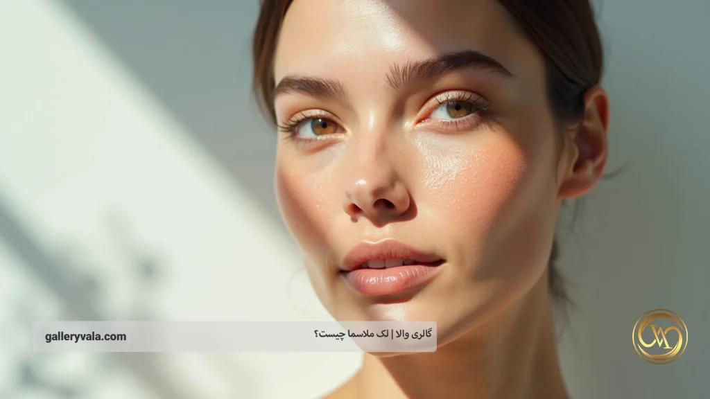 شناخت انواع مختلف لک ملاسما و ویژگیهای هرکدام