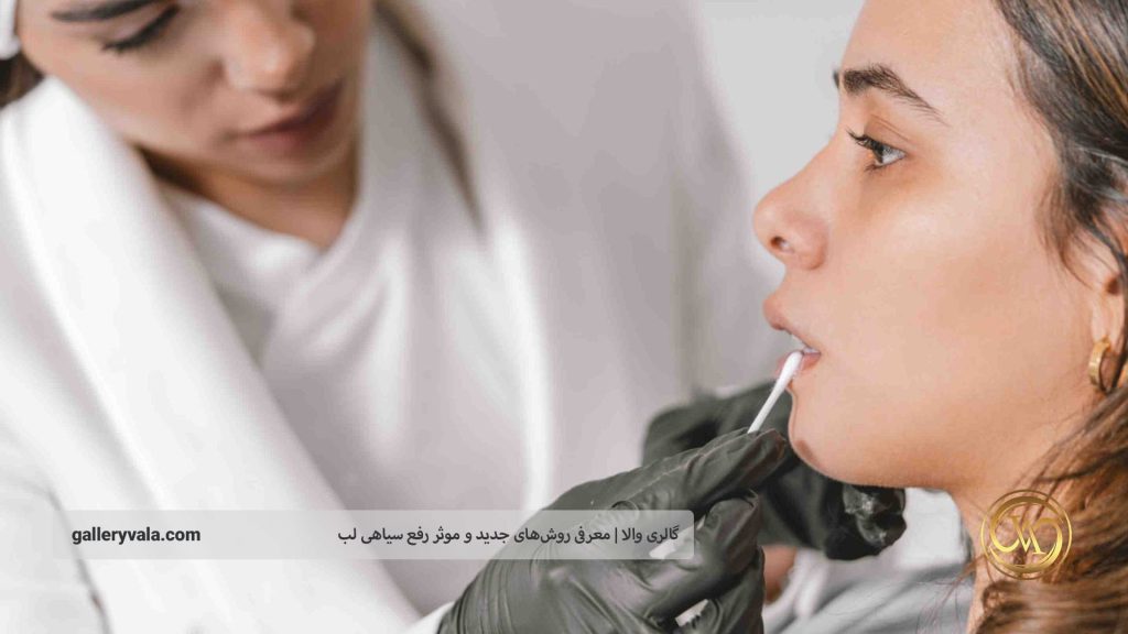 ترفندهای آرایشی برای پنهان کردن تیرگی لب | گالری والا